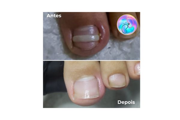 antes e depois 3